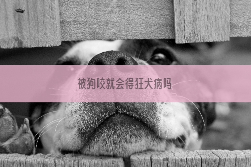 被狗咬就会得狂犬病吗